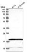 Nudix Hydrolase 2 antibody, HPA044903, Atlas Antibodies, Western Blot image 