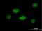Zinc Finger Protein 449 antibody, H00203523-B01P, Novus Biologicals, Immunofluorescence image 