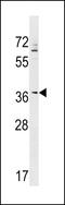 Zinc Finger Protein 385A antibody, LS-C157450, Lifespan Biosciences, Western Blot image 
