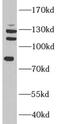 Transcription initiation factor TFIID subunit 3 antibody, FNab08485, FineTest, Western Blot image 