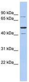 Structure Specific Recognition Protein 1 antibody, TA330074, Origene, Western Blot image 