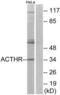 ACTH receptor antibody, LS-C120630, Lifespan Biosciences, Western Blot image 