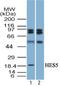 Hes Family BHLH Transcription Factor 5 antibody, TA337146, Origene, Western Blot image 