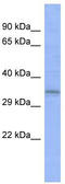 Oxidative Stress Responsive Serine Rich 1 antibody, TA345023, Origene, Western Blot image 