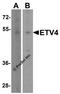 ETS Variant 4 antibody, A03184-1, Boster Biological Technology, Western Blot image 