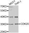 Cyclin Dependent Kinase 20 antibody, MBS128145, MyBioSource, Western Blot image 