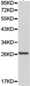 Glutathione S-transferase theta-1 antibody, TA323546, Origene, Western Blot image 