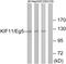 Kinesin-like protein KIF11 antibody, LS-C117973, Lifespan Biosciences, Western Blot image 