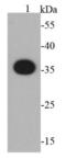 S-tag epitope tag antibody, NBP2-66795, Novus Biologicals, Western Blot image 