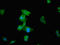 Sentrin-specific protease 2 antibody, LS-C672133, Lifespan Biosciences, Immunofluorescence image 