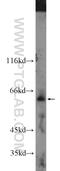 FAM20A Golgi Associated Secretory Pathway Pseudokinase antibody, 25258-1-AP, Proteintech Group, Western Blot image 