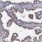 Chromosome 11 Open Reading Frame 96 antibody, PA5-58561, Invitrogen Antibodies, Immunohistochemistry frozen image 