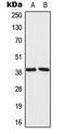 Mitochondrial Ribosomal Protein L39 antibody, LS-B13650, Lifespan Biosciences, Western Blot image 