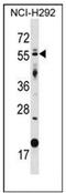 Zinc finger protein GLIS2 antibody, AP51852PU-N, Origene, Western Blot image 