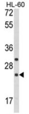 Regulator Of G Protein Signaling 1 antibody, AP18180PU-N, Origene, Western Blot image 
