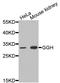 Gamma-Glutamyl Hydrolase antibody, A5464, ABclonal Technology, Western Blot image 