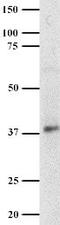 Aurora Kinase B antibody, ab3609, Abcam, Western Blot image 