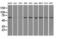 Leukotriene A4 Hydrolase antibody, GTX84170, GeneTex, Western Blot image 