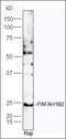 Cell Death Inducing DFFA Like Effector B antibody, orb10391, Biorbyt, Western Blot image 