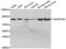 ADAM Metallopeptidase With Thrombospondin Type 1 Motif 4 antibody, abx001965, Abbexa, Western Blot image 