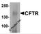 CF Transmembrane Conductance Regulator antibody, 7717, ProSci Inc, Western Blot image 