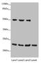 RAB18, Member RAS Oncogene Family antibody, LS-C676342, Lifespan Biosciences, Western Blot image 