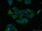 Kinesin Family Member 5C antibody, 25897-1-AP, Proteintech Group, Immunofluorescence image 