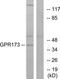 Probable G-protein coupled receptor 173 antibody, TA315518, Origene, Western Blot image 