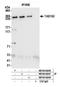 Tankyrase 1 Binding Protein 1 antibody, NB100-68249, Novus Biologicals, Western Blot image 
