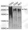 Fibronectin 1 antibody, A0966, ABclonal Technology, Western Blot image 
