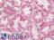 NFKB Inhibitor Delta antibody, LS-B12360, Lifespan Biosciences, Immunohistochemistry paraffin image 