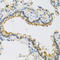 FAM20A Golgi Associated Secretory Pathway Pseudokinase antibody, A05777, Boster Biological Technology, Immunohistochemistry paraffin image 
