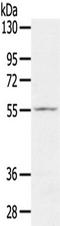Solute Carrier Family 16 Member 11 antibody, TA351680, Origene, Western Blot image 