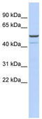 Potassium Two Pore Domain Channel Subfamily K Member 12 antibody, TA338708, Origene, Western Blot image 