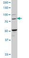 BTB Domain And CNC Homolog 1 antibody, H00000571-M02, Novus Biologicals, Western Blot image 