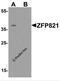 Zinc Finger Protein 821 antibody, 7537, ProSci Inc, Western Blot image 