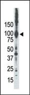 Protein Kinase C Epsilon antibody, PA5-13745, Invitrogen Antibodies, Western Blot image 