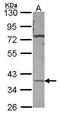 Carbonic anhydrase-related protein 11 antibody, TA308859, Origene, Western Blot image 