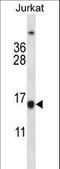 BCL2 antibody, LS-C156771, Lifespan Biosciences, Western Blot image 