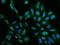 ELOVL Fatty Acid Elongase 5 antibody, 202473-T10, Sino Biological, Immunohistochemistry frozen image 