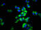 Melanin Concentrating Hormone Receptor 2 antibody, LS-C675166, Lifespan Biosciences, Immunofluorescence image 
