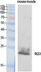 Regulator Of G Protein Signaling 1 antibody, A04483, Boster Biological Technology, Western Blot image 
