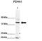 Pyruvate Dehydrogenase E1 Alpha 1 Subunit antibody, TA346531, Origene, Western Blot image 