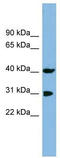 Peptidylprolyl Isomerase D antibody, TA342237, Origene, Western Blot image 