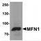 Mitofusin 1 antibody, TA349063, Origene, Western Blot image 