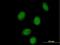 Single Stranded DNA Binding Protein 2 antibody, H00023635-B01P, Novus Biologicals, Immunocytochemistry image 