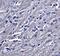 SYNPO antibody, A03154, Boster Biological Technology, Immunohistochemistry paraffin image 