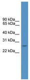 Homeobox protein DLX-4 antibody, TA345498, Origene, Western Blot image 