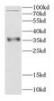 Copper chaperone for superoxide dismutase antibody, FNab01395, FineTest, Western Blot image 
