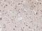 Zinc finger protein RFP antibody, PA5-67533, Invitrogen Antibodies, Immunohistochemistry paraffin image 